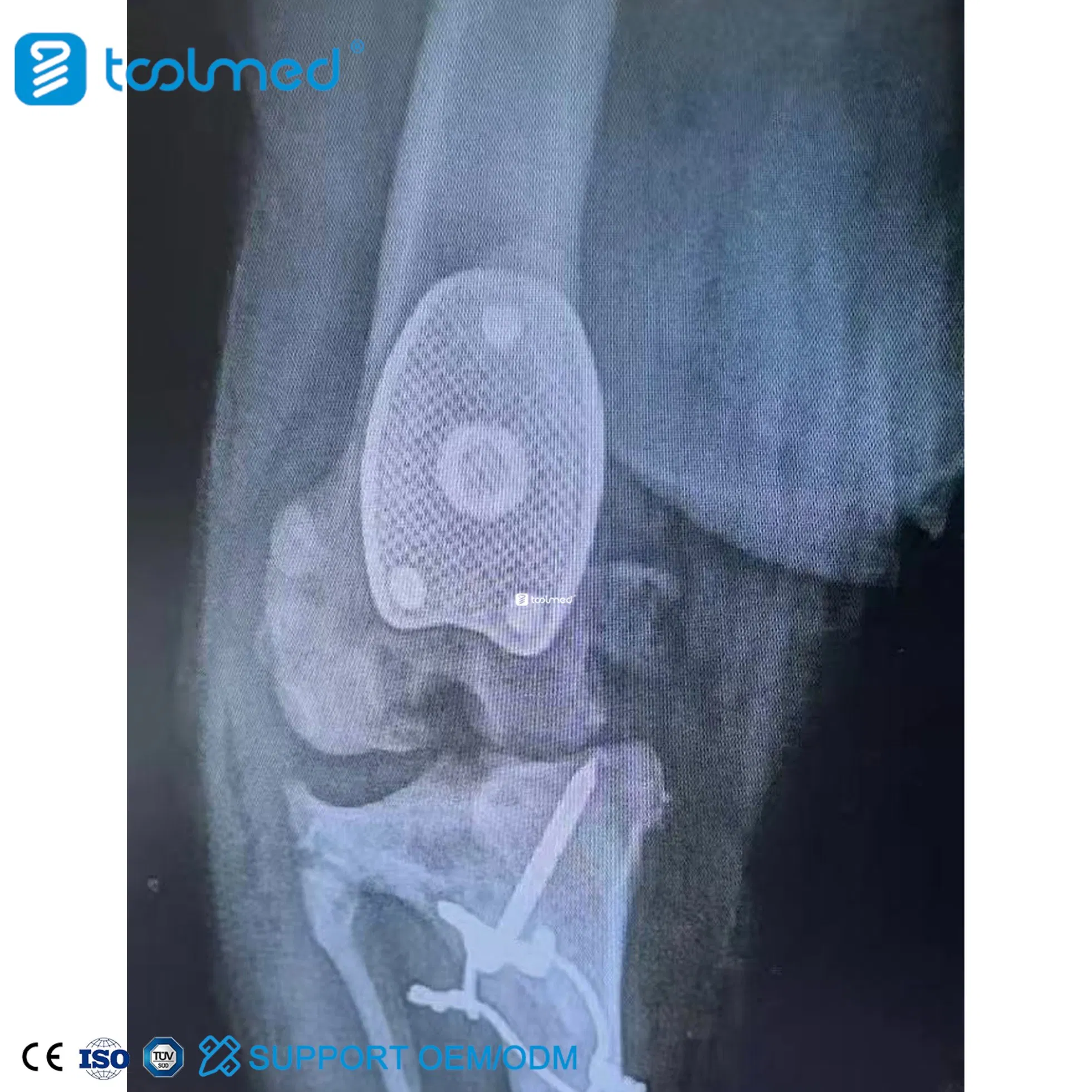 Veterinary Orthopedic Knee Prosthesis Replacement Medical Kit Patellar Groove Replacement (PGR) Instrument Set for Pet Surgery