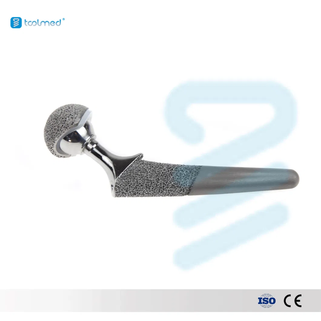 Hip Joint Replacement