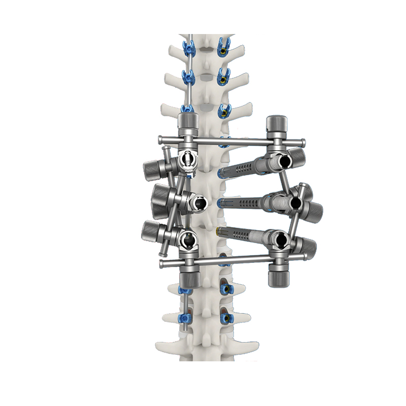 Precision Offset Lamina Hook Forlumbosacral Fusion Surgery