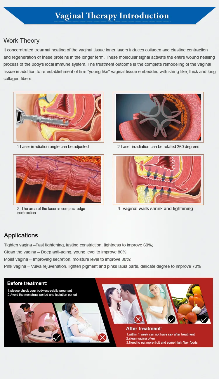 Treatment Effect 1