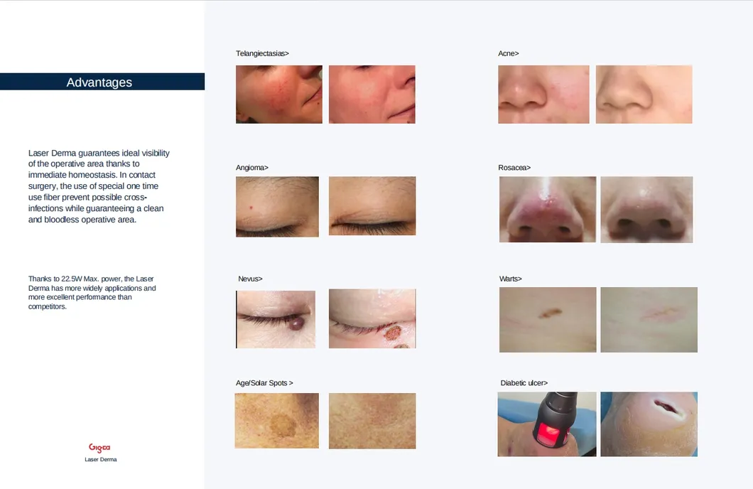 Skin Therapy Device