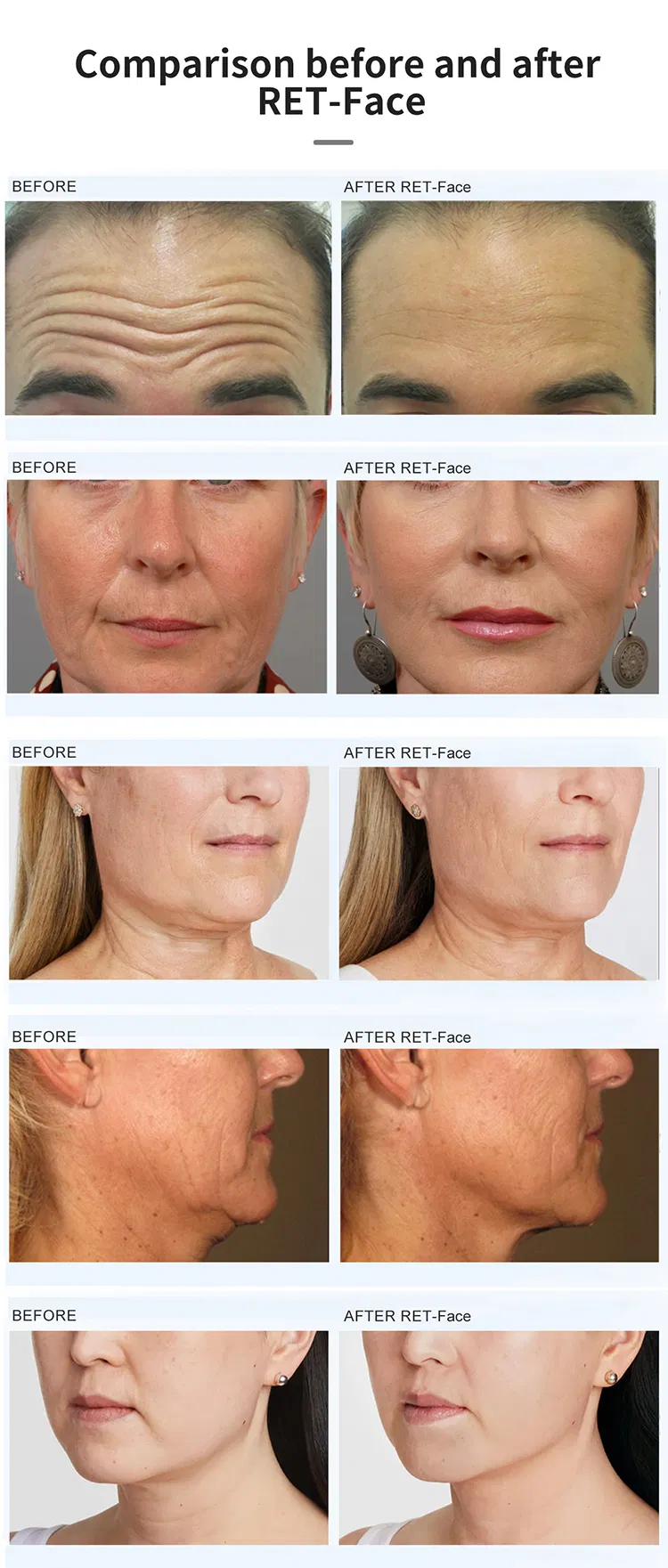 Treatment Result 1