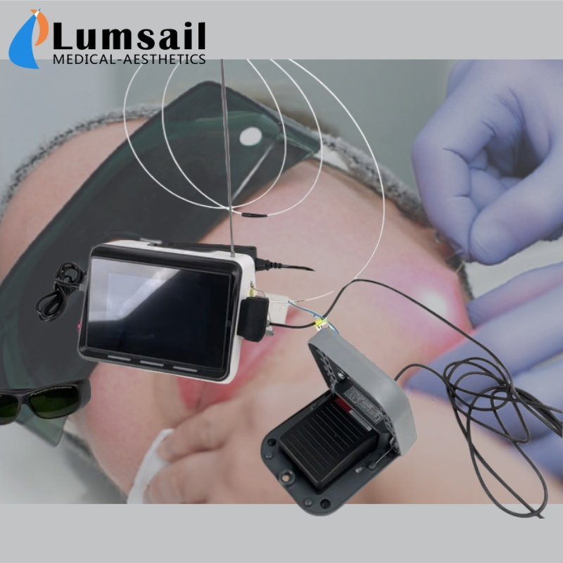 1470nm Endolift Laser System for Skin Tightening &amp; Fat Remodeling