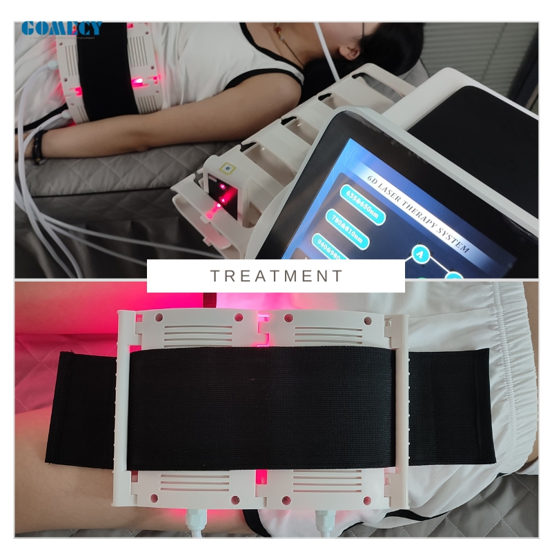 Professional 6D Lipo Laser Weight Loss Beauty Machine for Salon SPA Clinic and Home Use Treatment