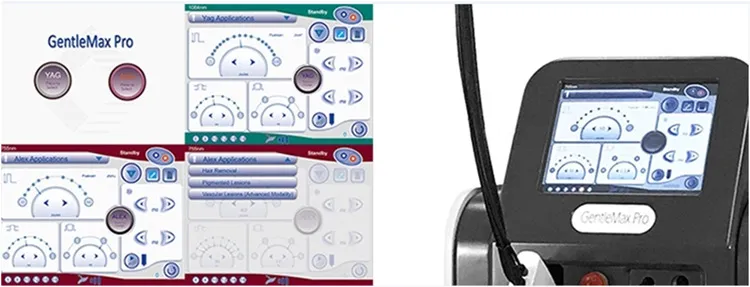 Smart Interface
