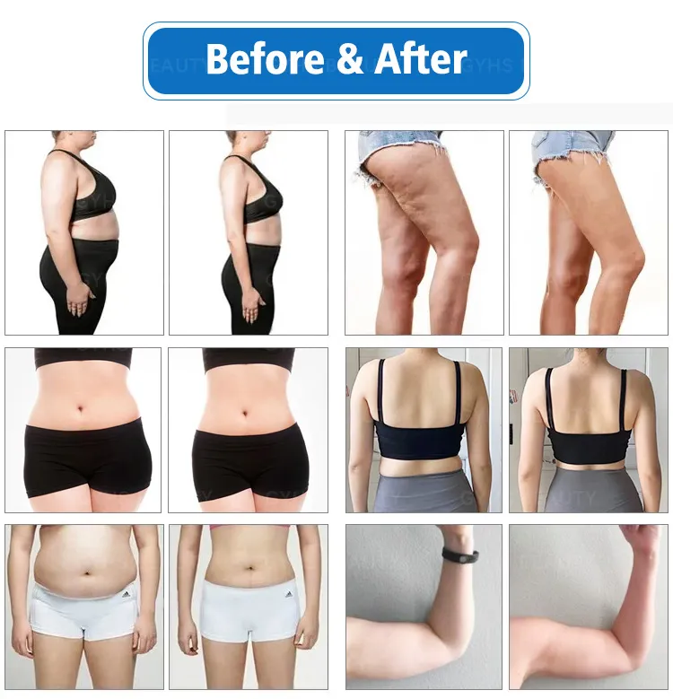 Before and After Results