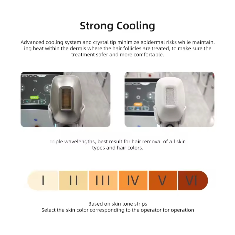 Portable Single Handle Diode Ice Laser Hair Removal Machine High Quality Cooling System for Long Time Hair Removal