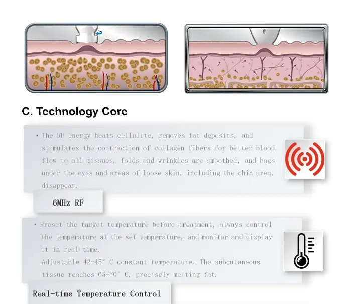 Slimming System Detail 1