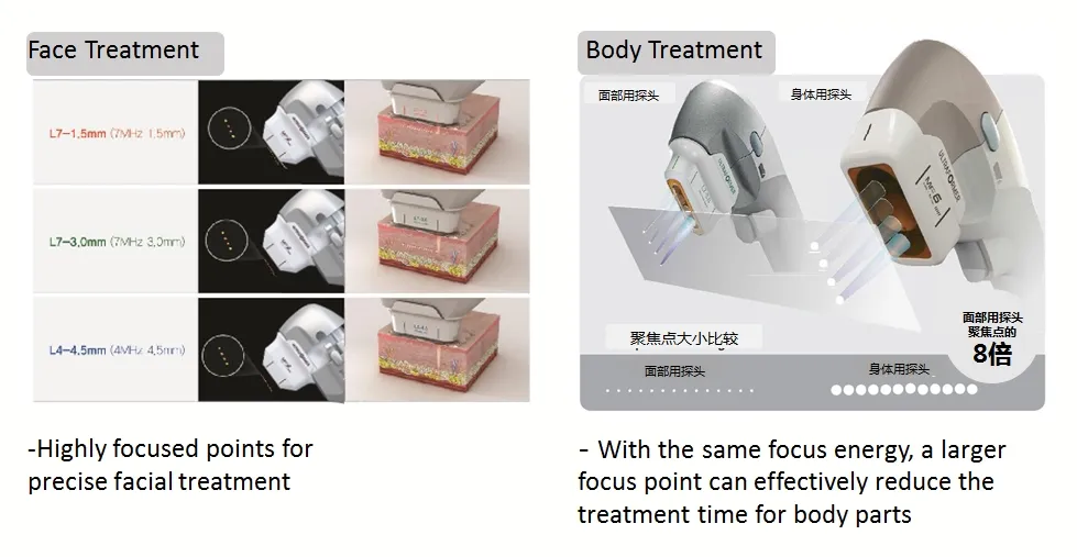 7D HIFU Machine
