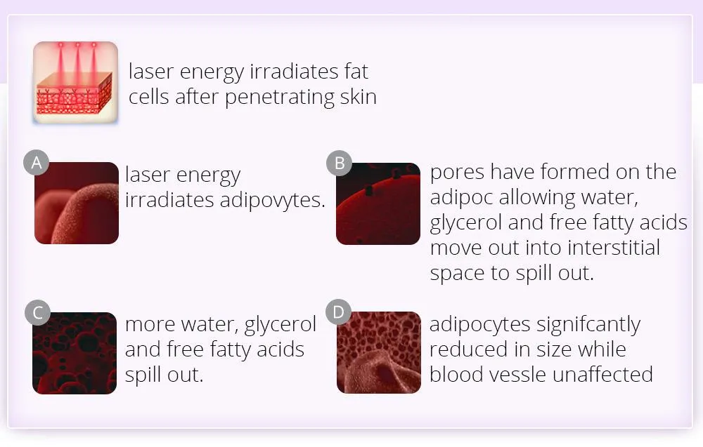 Photon Therapy