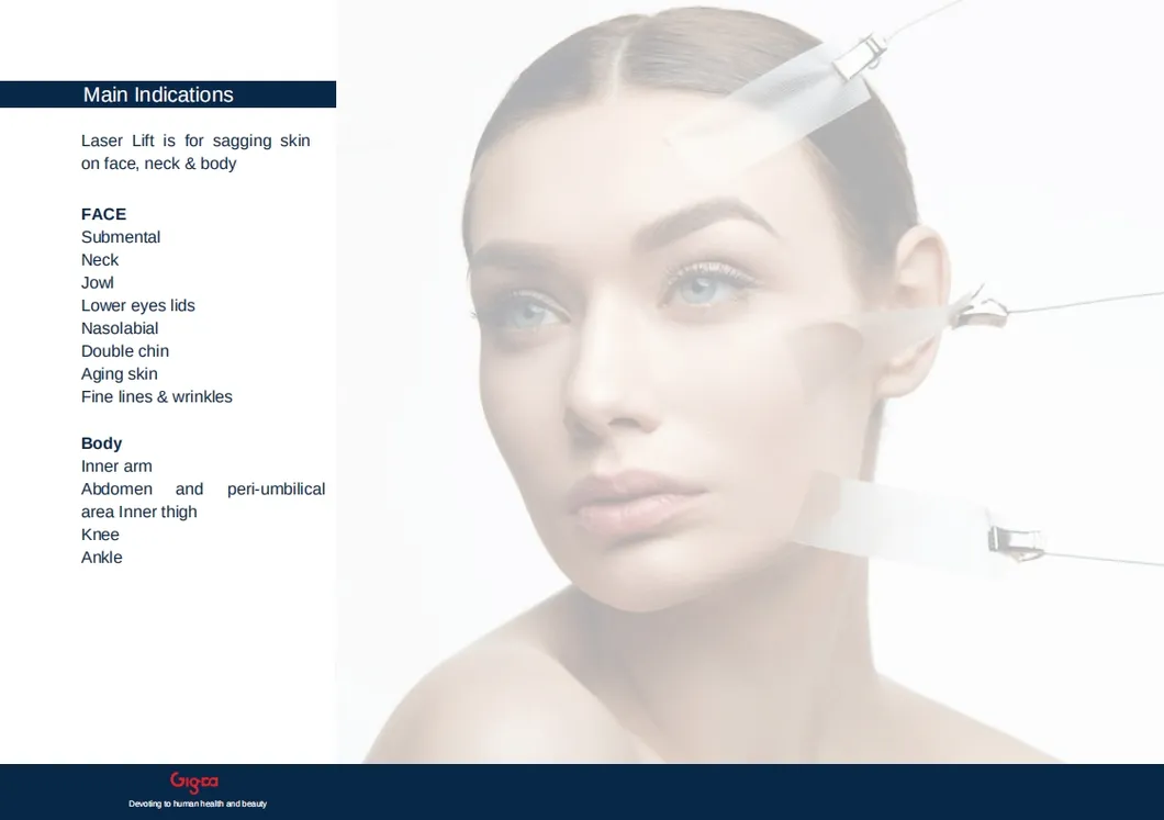 Laser Lift Treatment