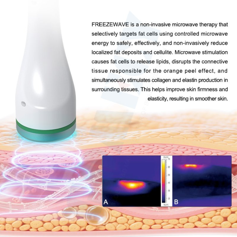 Aesthetic Cold Wave Body Contouring System for Skin Firming Treatments