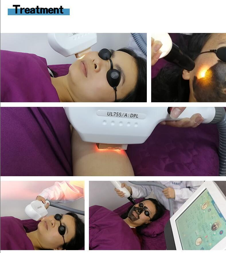 Gomecy Latest Dpl+Pico Laser 2 in 1 Machine Double System for Hair Removal Tattoo Removal Carbon Peeling Skin Rejuvenation