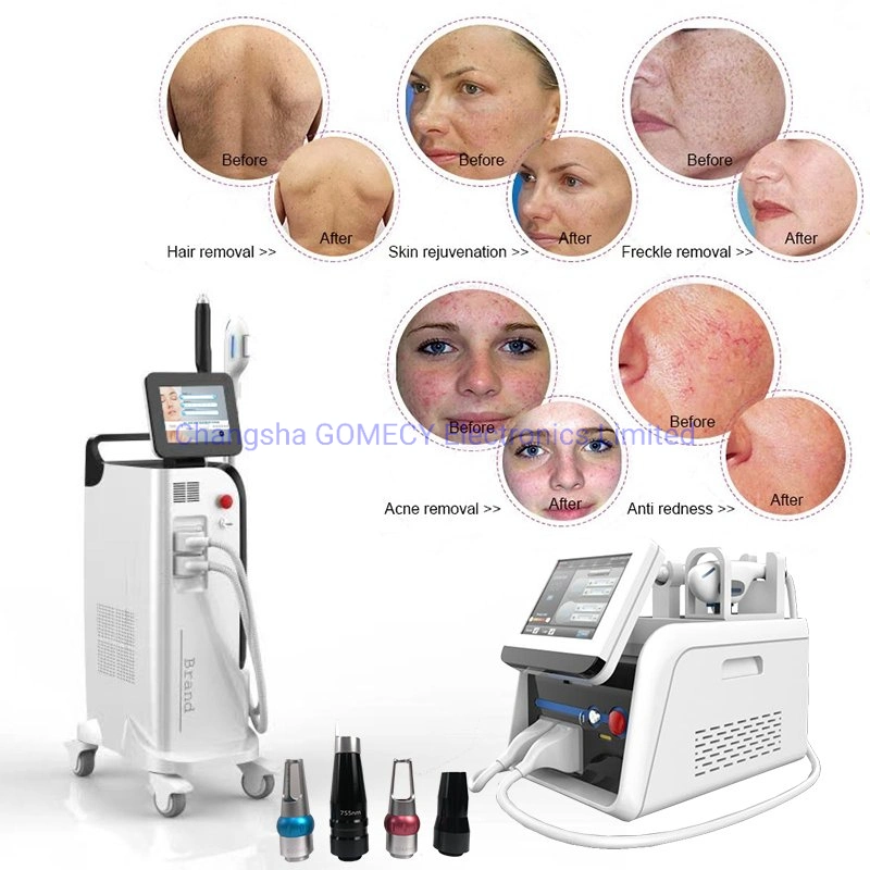 Laser Machine View