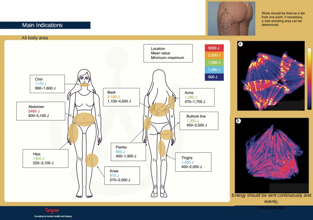 Laser Lipolysis Treatment