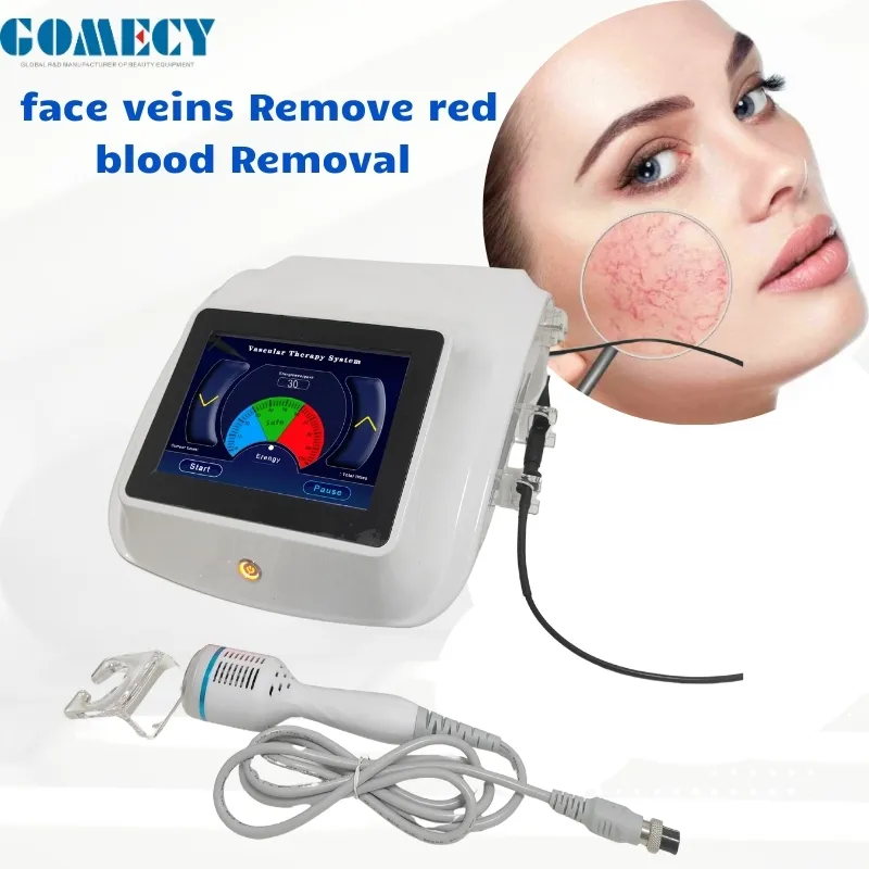 Treatment Result