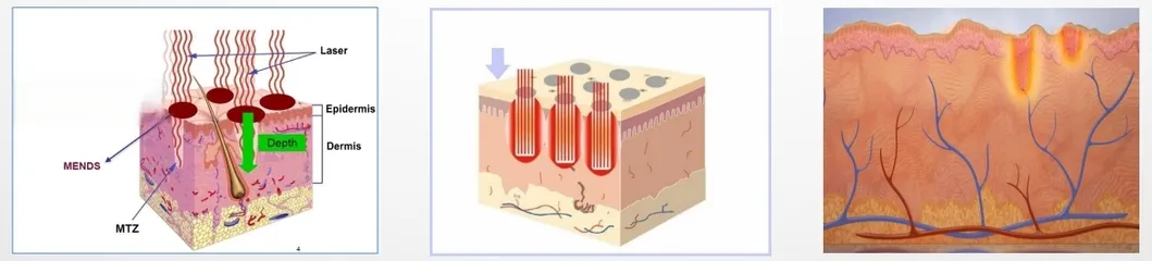 Microscopic Thermal Damage Zone