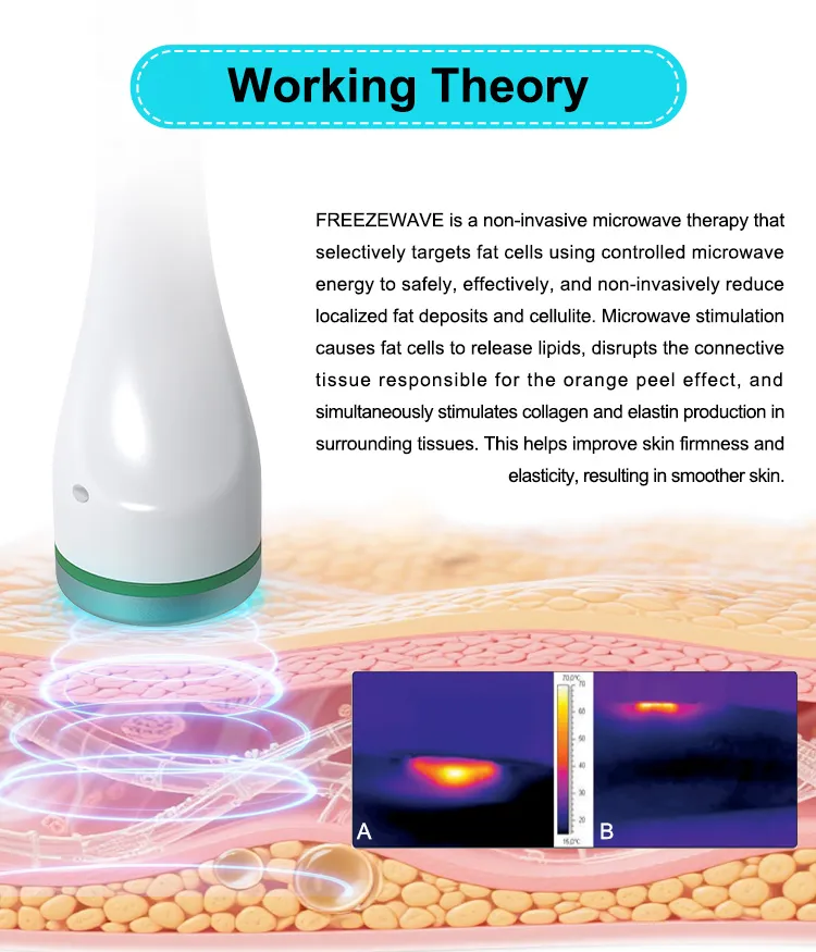 Freeze Wave System Display 2