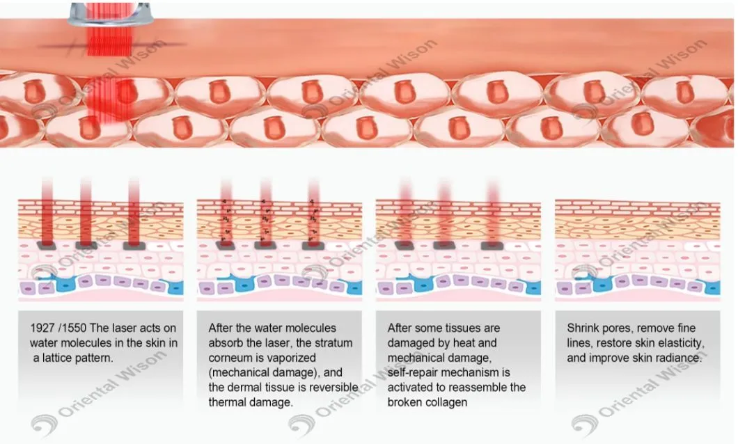 Therapy Mechanism