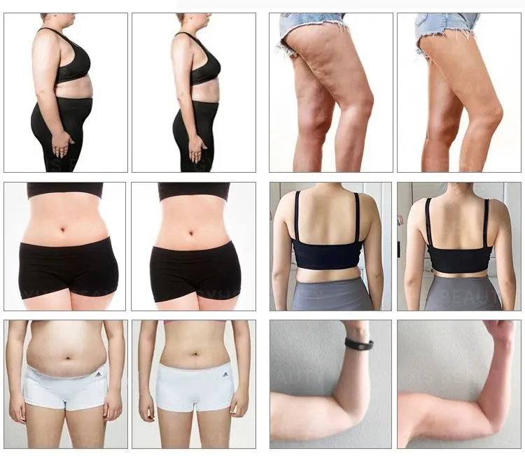 Before and After 1