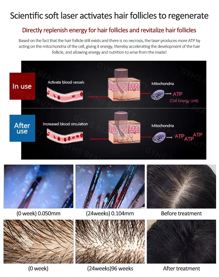 Hair Growth Device 3