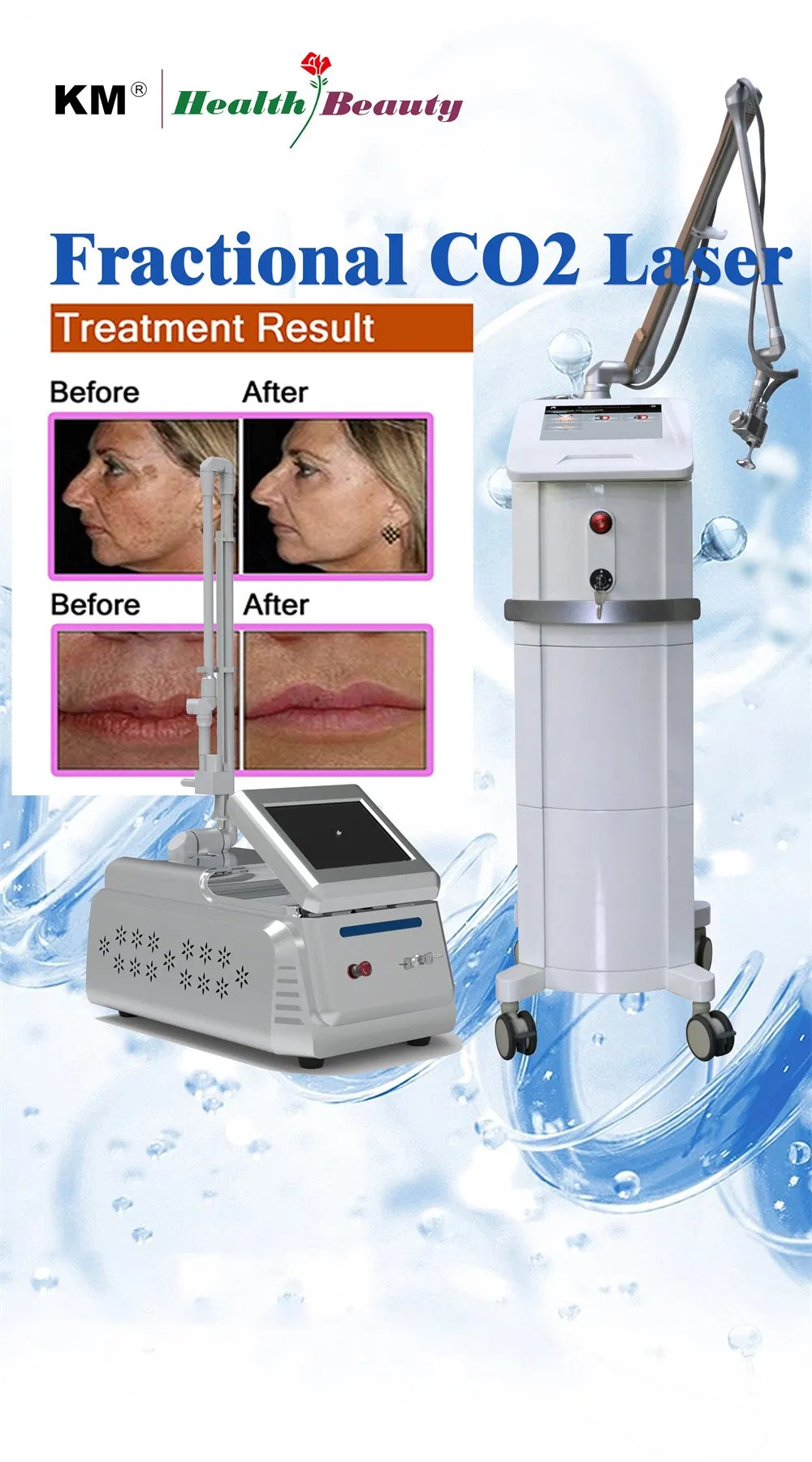 Fractional CO2 Laser, Professional Skin Resurfacing Scar Removal Machine, USA RF Tube CO2 Medical Aesthetic Laser System