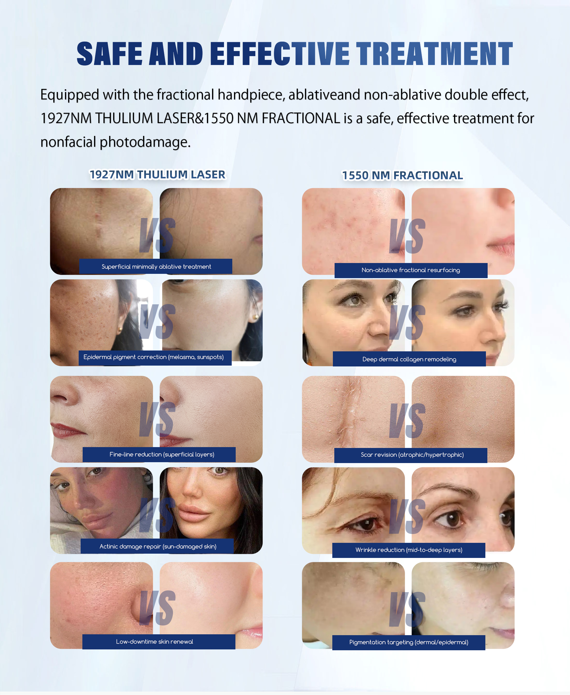 Fiber Laser Fractional Laser Scar Removal Pigmentation Removal Melasma Removal Acne Treatment 1927nm Thulium Laser Machine