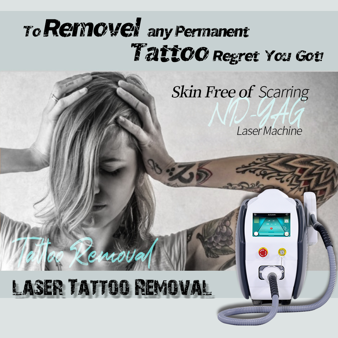 2023 Hot Nd Yag Q Switched Laser Laser Q Switch Nd Yag Carbon Peeling Yag Laser Machine