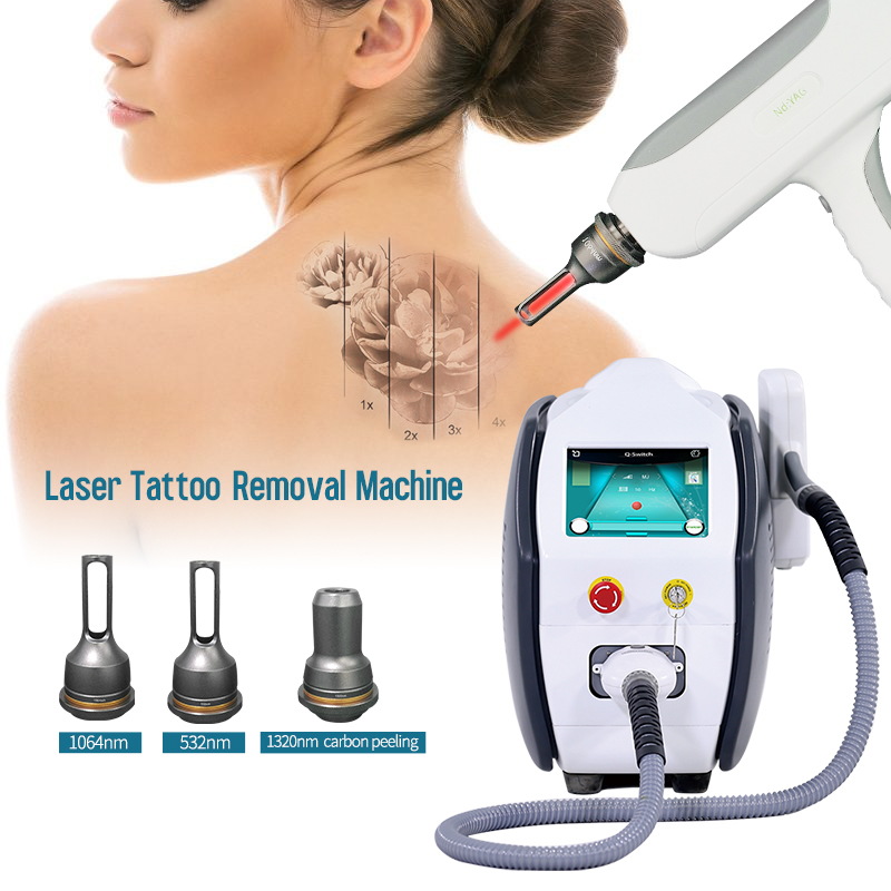 2023 Hot Nd Yag Q Switched Laser Laser Q Switch Nd Yag Carbon Peeling Yag Laser Machine