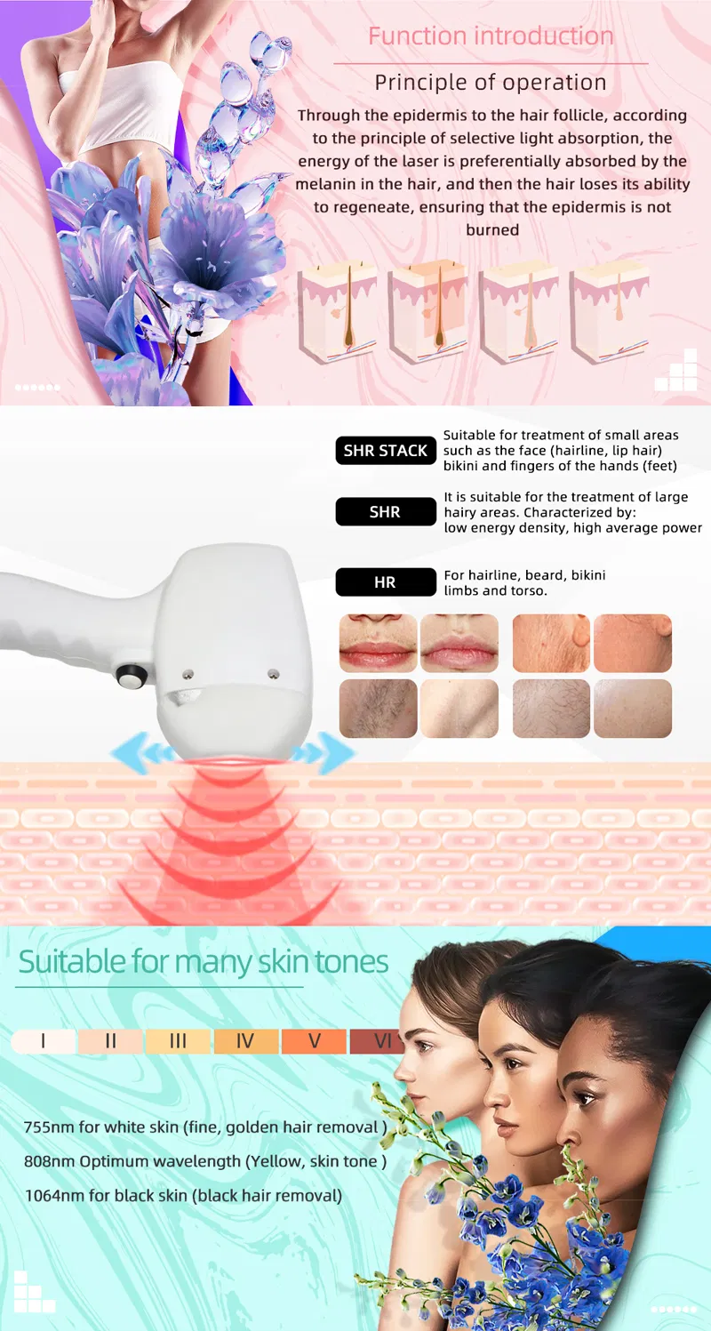 Treatment Handle Details