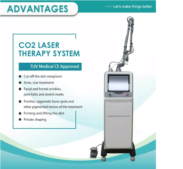 Advantages Diagram