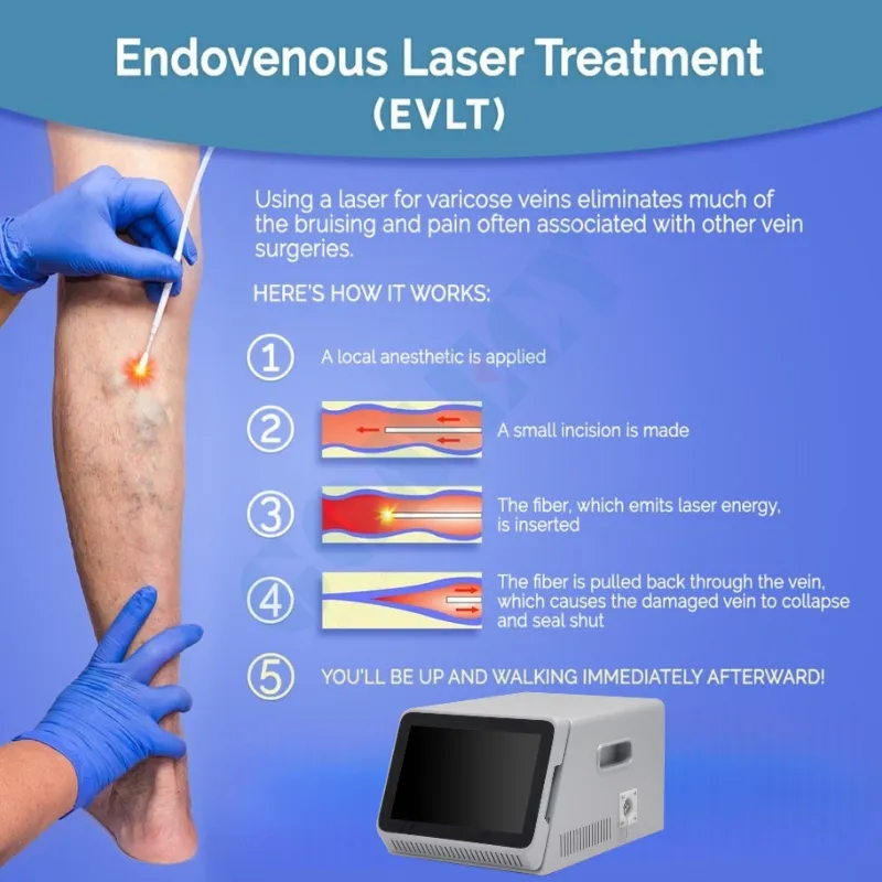 1940nm Fiber Laser System