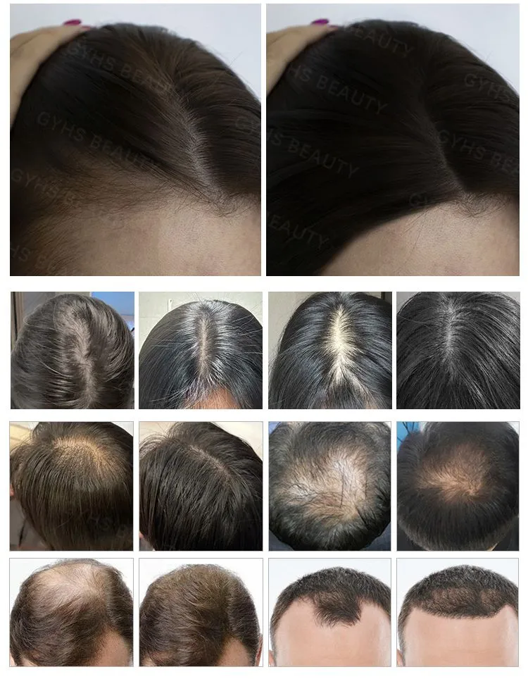 Before and After Results