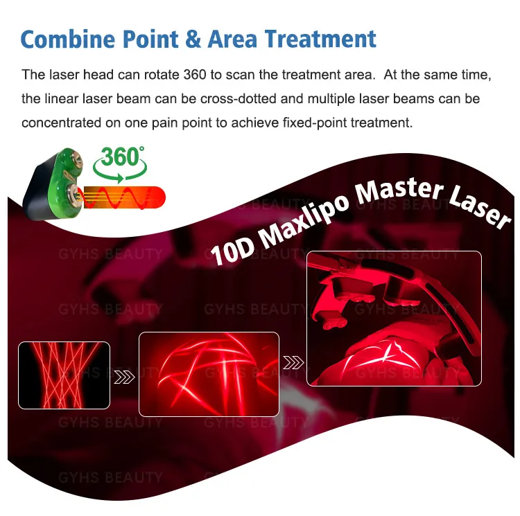 Lipo Laser