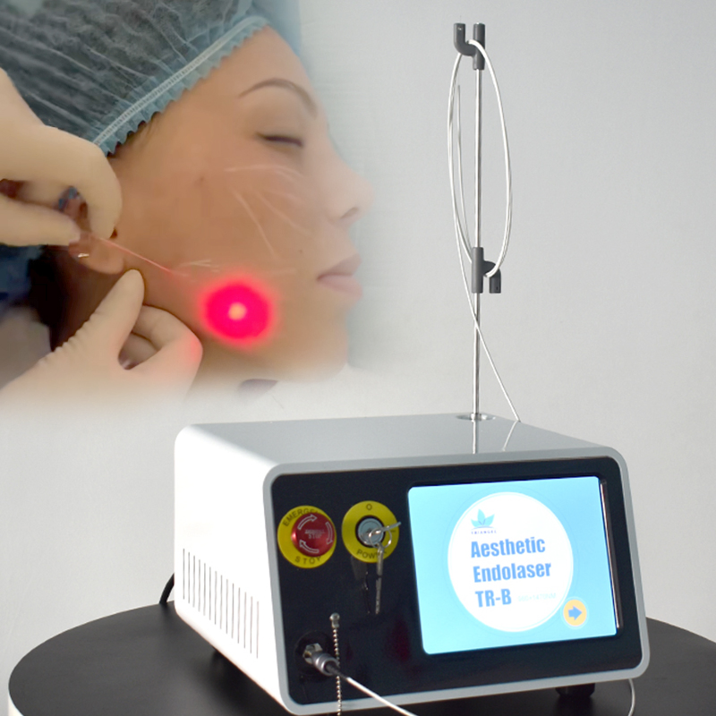 Diode Laser Lipolysis Liposuction Machine Facial Lipo Cellulite Reduction Endolift Laser Slimming