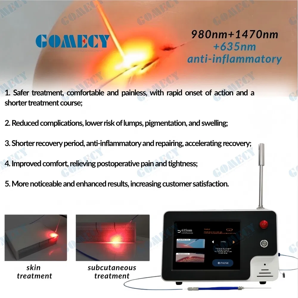Portable 1470nm 980nm Endolaser Acne Treatment Lipolysis Face Lift Weight Loss Desktop Style Opt Opt Fiber Plddevlt Endolifting