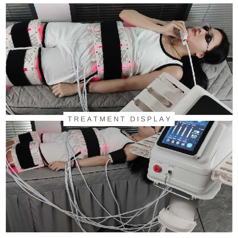 6D Lipo Laser Slimming Equipment for Beauty Clinic with Adjustable Energy and Safe Fat Reduction