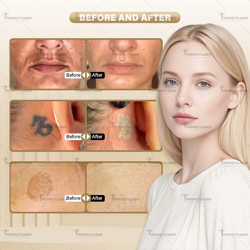Treatment Result 2