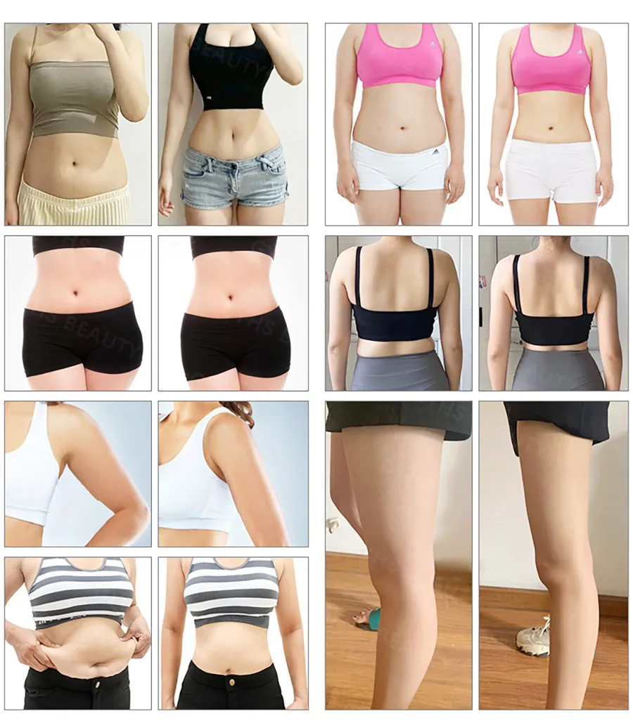 Before and After 1