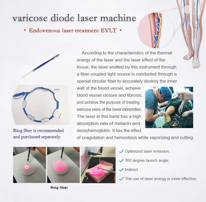 Laser Application 2