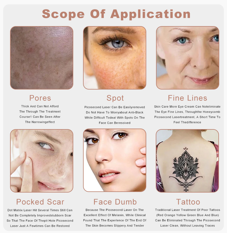 YAG Laser Water Temperature Control System for Uniform Light Spot Tattoo Eraser Birthmark Removal Tech Tattoo Pigment Freckle Removal Skin Rejuvenation Machine