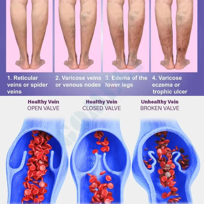 Laser System Detail