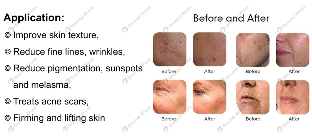 Before and After 2