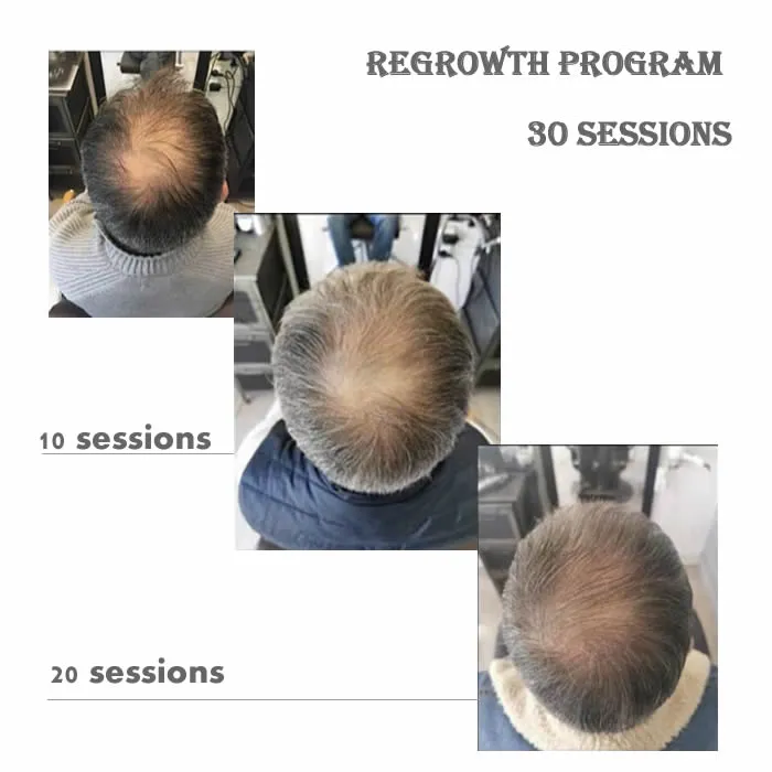 Result Visualization