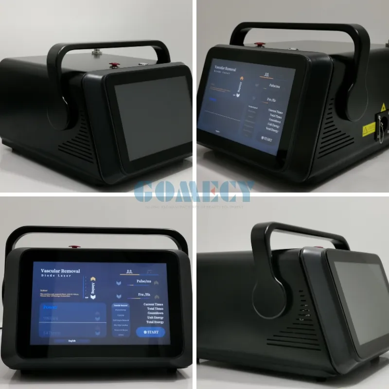 Laser Treatment Visualization