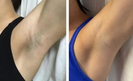 Before and After 2