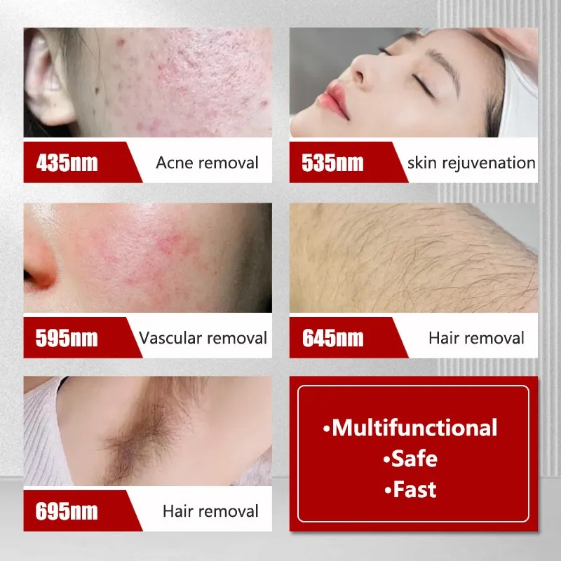 Multifunctional Bbl IPL Device for Hair Removal Skin Tightening Pigment Removal