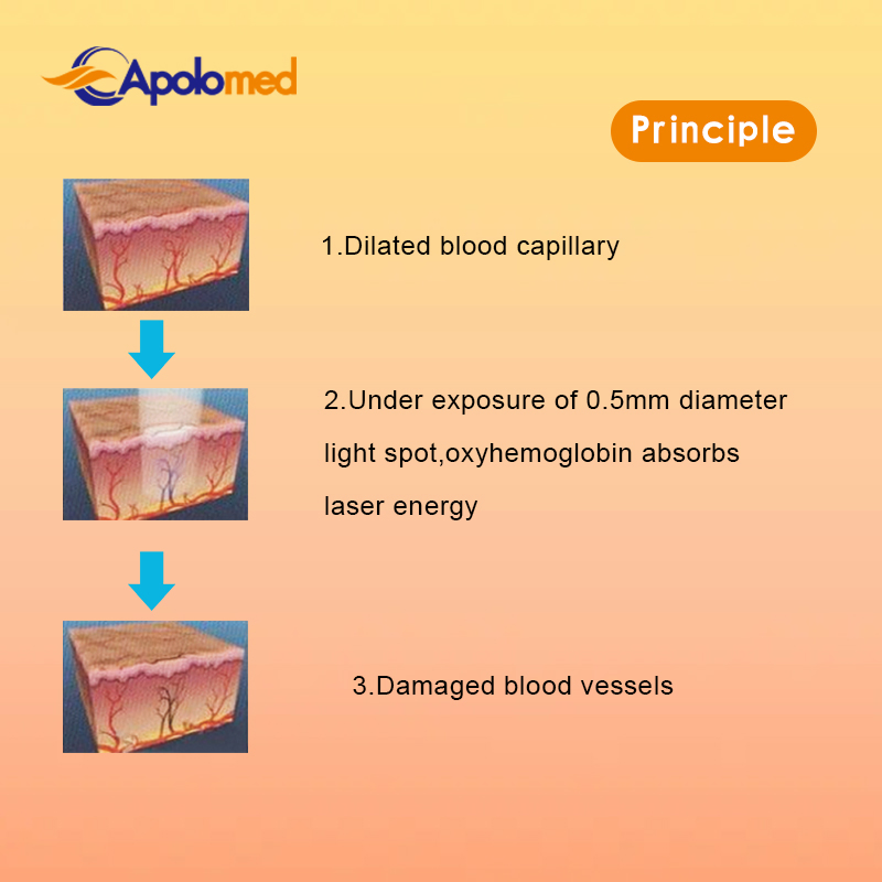 Hot Selling Versatile Red Light Therapy Alexandrite Picosecond Laser Vascular Removal Device