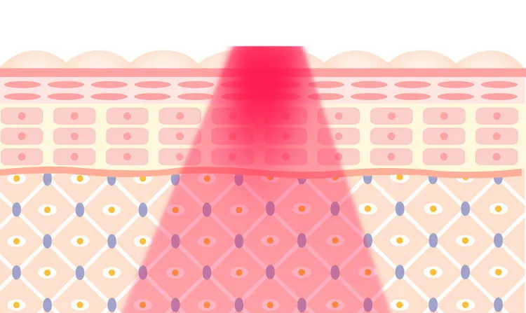 RF Principle