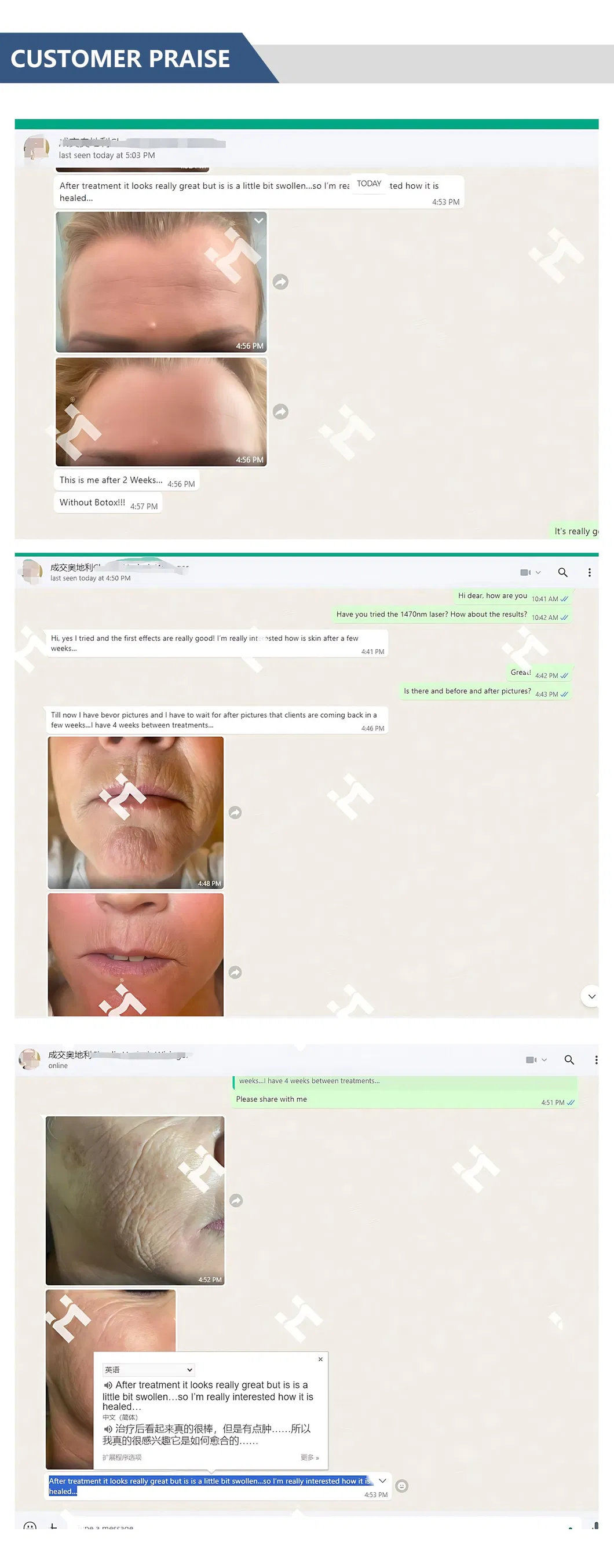 1470nm Laser Painless Facial Wrinkle Removal Skin Tightening System
